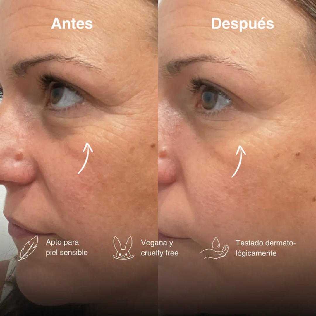 Roll-on eye serum