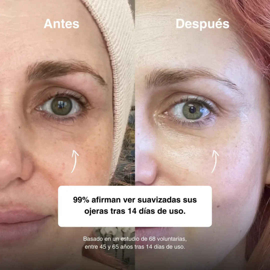 Roll-on eye serum
